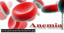 anemia skutki, anemia powody, leczenie